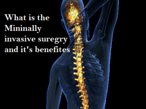 Dr. Rahul Chaudhari - Spine Surgeon in Pune