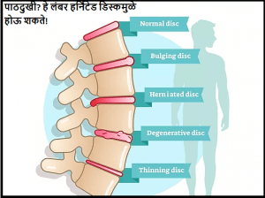 Dr. Rahul Chaudhari - Spine Surgeon in Pune
