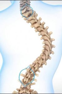 Spine surgeon in pune